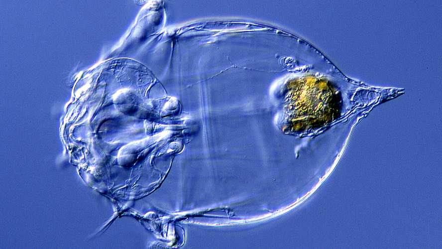 Fish farmers take advantage of machine learning to identify healthy microscopic rotifers. Photo source: Shutterstock 